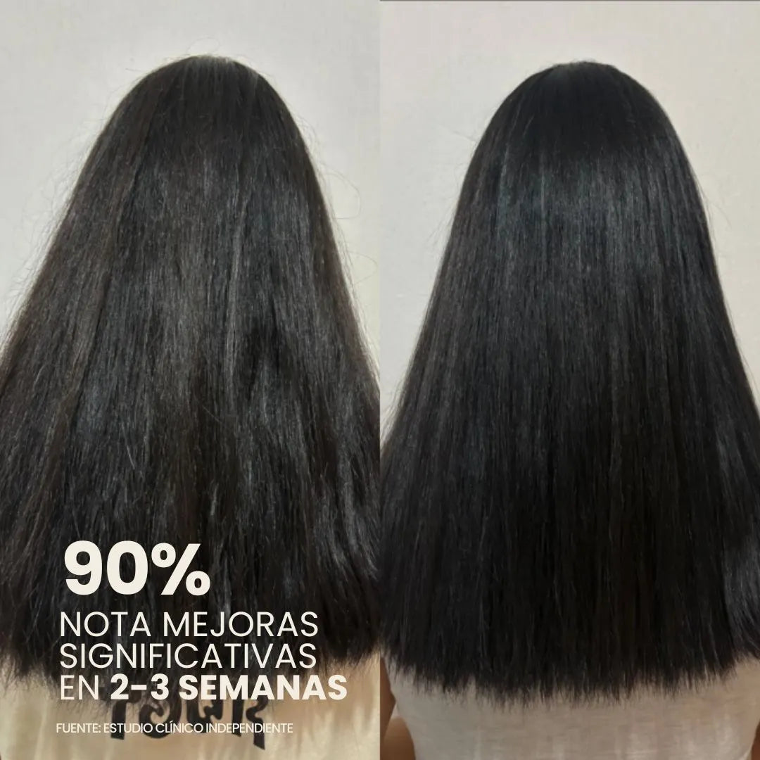 Barra Antisarro Aquamag